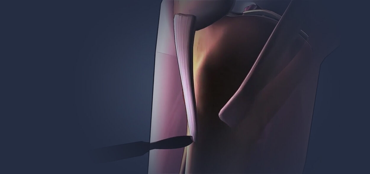 animação cirúrgica