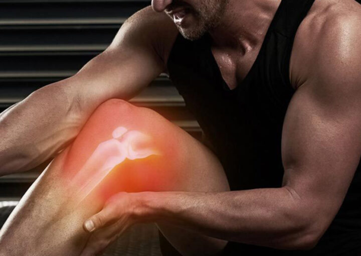 ilustração joelho inflamado