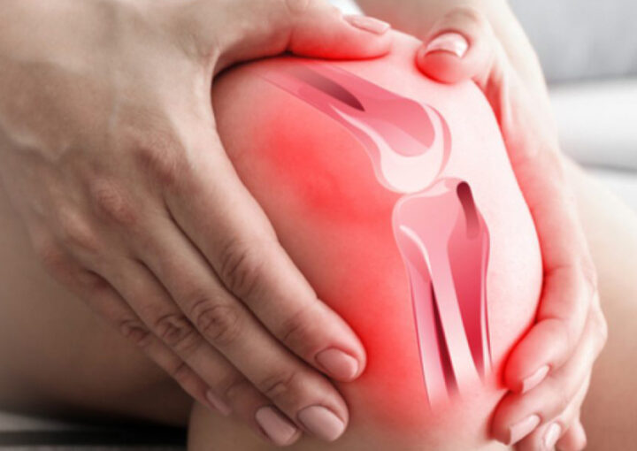 Lesão parcial do ligamento