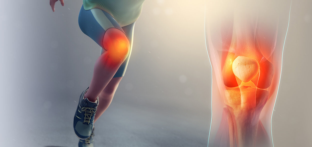 Joelho inflamado