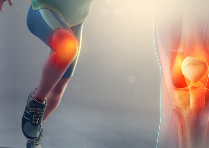 Joelho inflamado