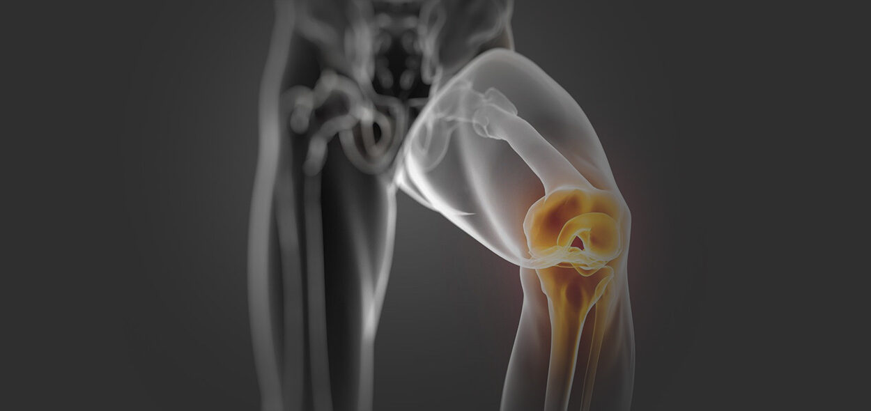 reconstrução do ligamento cruzado