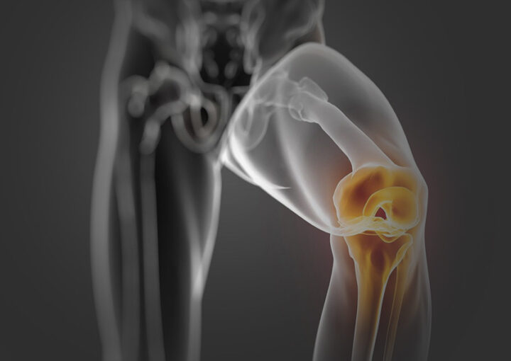 reconstrução do ligamento cruzado