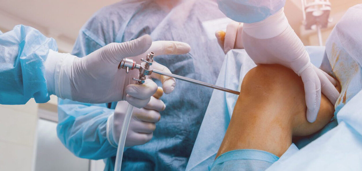 Cirurgia de revisão