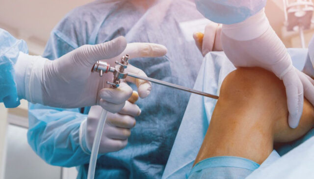 Cirurgia de revisão