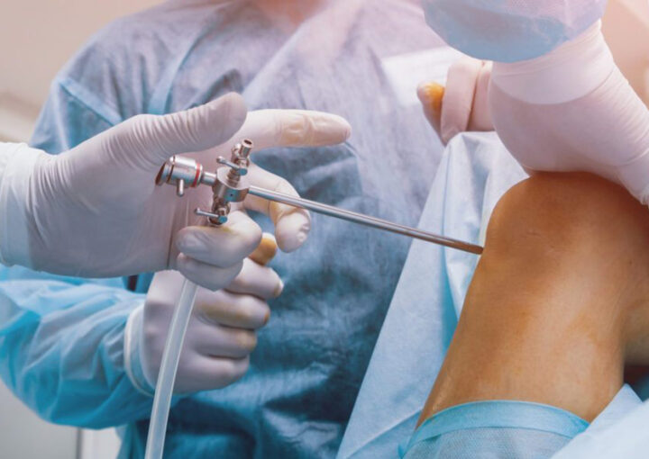 Cirurgia de revisão